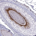 Immunohistochemical staining of human skin shows strong cytoplasmic positivity in hair follicle.