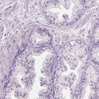 Immunohistochemical staining of human prostate shows no positivity in glandular cells as expected.