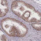 Anti-RABL6 Antibody