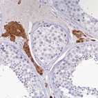 Immunohistochemical staining of human testis shows strong cytoplasmic positivity in Leydig cells.