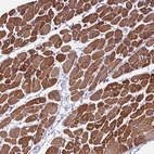 Immunohistochemical staining of human heart muscle shows strong cytoplasmic positivity in cardiomyocytes.