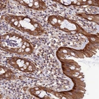 Anti-LEKR1 Antibody