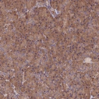 Immunohistochemical staining of human pancreas shows strong cytoplasmic positivity in exocrine glandular cells.