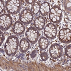 Immunohistochemical staining of human colon shows strong cytoplasmic positivity in glandular cells.