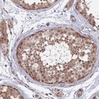 Immunohistochemical staining of human testis shows strong cytoplasmic positivity in cells in seminiferous ducts.