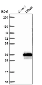 Western blot analysis in control (vector only transfected HEK293T lysate) and UROS over-expression lysate (Co-expressed with a C-terminal myc-DDK tag (~3.1 kDa) in mammalian HEK293T cells, LY424759).