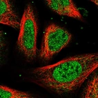 Immunofluorescent staining of human cell line U-2 OS shows localization to nucleoplasm & cytosol.