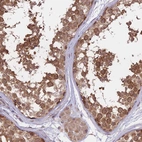 Anti-FABP12 Antibody
