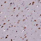 Anti-GLYATL3 Antibody