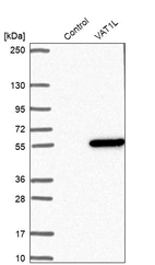 Western blot analysis in control (vector only transfected HEK293T lysate) and VAT1L over-expression lysate (Co-expressed with a C-terminal myc-DDK tag (~3.1 kDa) in mammalian HEK293T cells, LY412225).