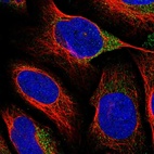 Immunofluorescent staining of human cell line U-2 OS shows localization to cytosol.