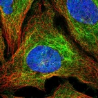 Immunofluorescent staining of human cell line U-2 OS shows localization to intermediate filaments.