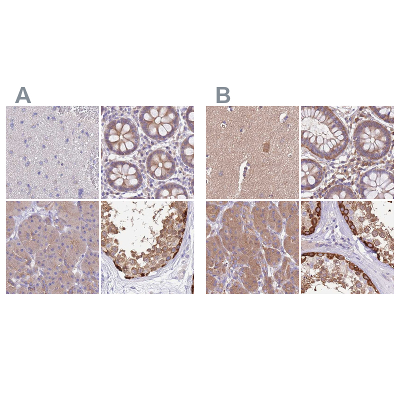 Anti-STIP1 Antibody