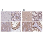 Anti-STIP1 Antibody