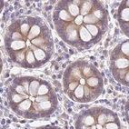 Immunohistochemical staining of human colon using Anti-STIP1 antibody HPA044062.