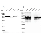 Western blot analysis using Anti-STIP1 antibody HPA044062 (A) shows similar pattern to independent antibody HPA039291 (B).