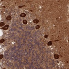 Anti-ALKBH1 Antibody