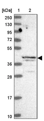 Lane 1: Marker [kDa] 250, 130, 95, 72, 55, 36, 28, 17, 10_br/_Lane 2: Human cell line RT-4