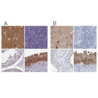 Immunohistochemical staining of human cerebral cortex, lymph node, testis and urinary bladder using Anti-SRGAP3 antibody HPA044074 (A) shows similar protein distribution across tissues to independent antibody HPA036959 (B).
