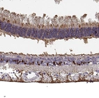 Immunohistochemical staining of human eye shows strong cytoplasmic positivity in photoreceptor cells.