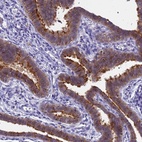 Immunohistochemical staining of human fallopian tube shows high expression.