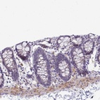 Immunohistochemical staining of human colon shows low expression as expected.