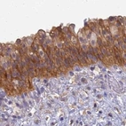 Immunohistochemical staining of human urinary bladder using Anti-SRGAP3 antibody HPA044074.