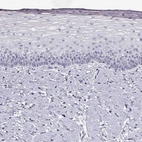 Immunohistochemical staining of human cervix shows no positivity in squamous epithelial cells as expected.
