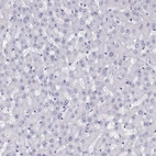 Immunohistochemical staining of human liver shows no positivity in hepatocytes as expected.