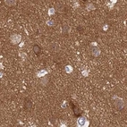 Immunohistochemical staining of human cerebral cortex using Anti-SRGAP3 antibody HPA044074.