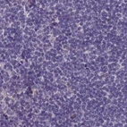 Immunohistochemical staining of human lymph node using Anti-SRGAP3 antibody HPA044074.