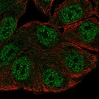 Immunofluorescent staining of human cell line RT4 shows localization to nucleoplasm.