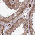 Anti-CCS Antibody