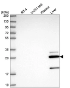 Western blot analysis in human cell line RT-4, human cell line U-251 MG, human plasma and human liver tissue.