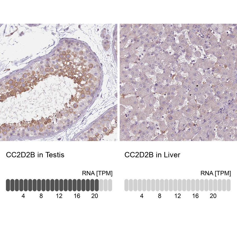 Anti-CC2D2B Antibody