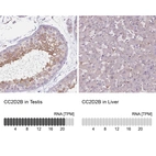 Anti-CC2D2B Antibody