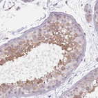 Immunohistochemical staining of human testis shows high expression.