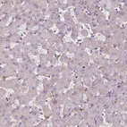 Immunohistochemical staining of human liver shows low expression as expected.