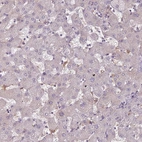 Immunohistochemical staining of human liver shows low expression as expected.