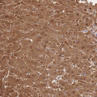 Immunohistochemical staining of human liver shows moderate cytoplasmic positivity in hepatocytes.