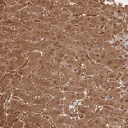 Immunohistochemical staining of human liver shows moderate cytoplasmic positivity in hepatocytes.