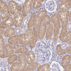 Immunohistochemical staining of human kidney shows moderate cytoplasmic positivity in cells in tubules.