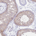 Immunohistochemical staining of human testis shows moderate cytoplasmic positivity in cells in seminiferous ducts.