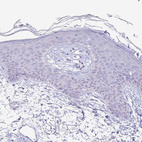 Immunohistochemical staining of human skin shows no positivity in squamous epithelial cells as expected.