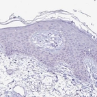 Immunohistochemical staining of human skin shows no positivity in squamous epithelial cells as expected.