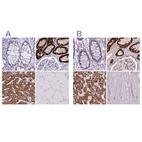 Immunohistochemical staining of human colon, kidney, liver and skeletal muscle using Anti-GLYAT antibody HPA044094 (A) shows similar protein distribution across tissues to independent antibody HPA040251 (B).