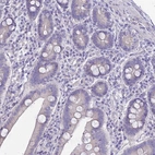 Immunohistochemical staining of human duodenum shows low expression as expected.