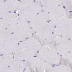 Immunohistochemical staining of human skeletal muscle using Anti-GLYAT antibody HPA044094.