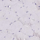 Immunohistochemical staining of human skeletal muscle using Anti-GLYAT antibody HPA044094.