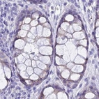 Immunohistochemical staining of human colon using Anti-GLYAT antibody HPA044094.